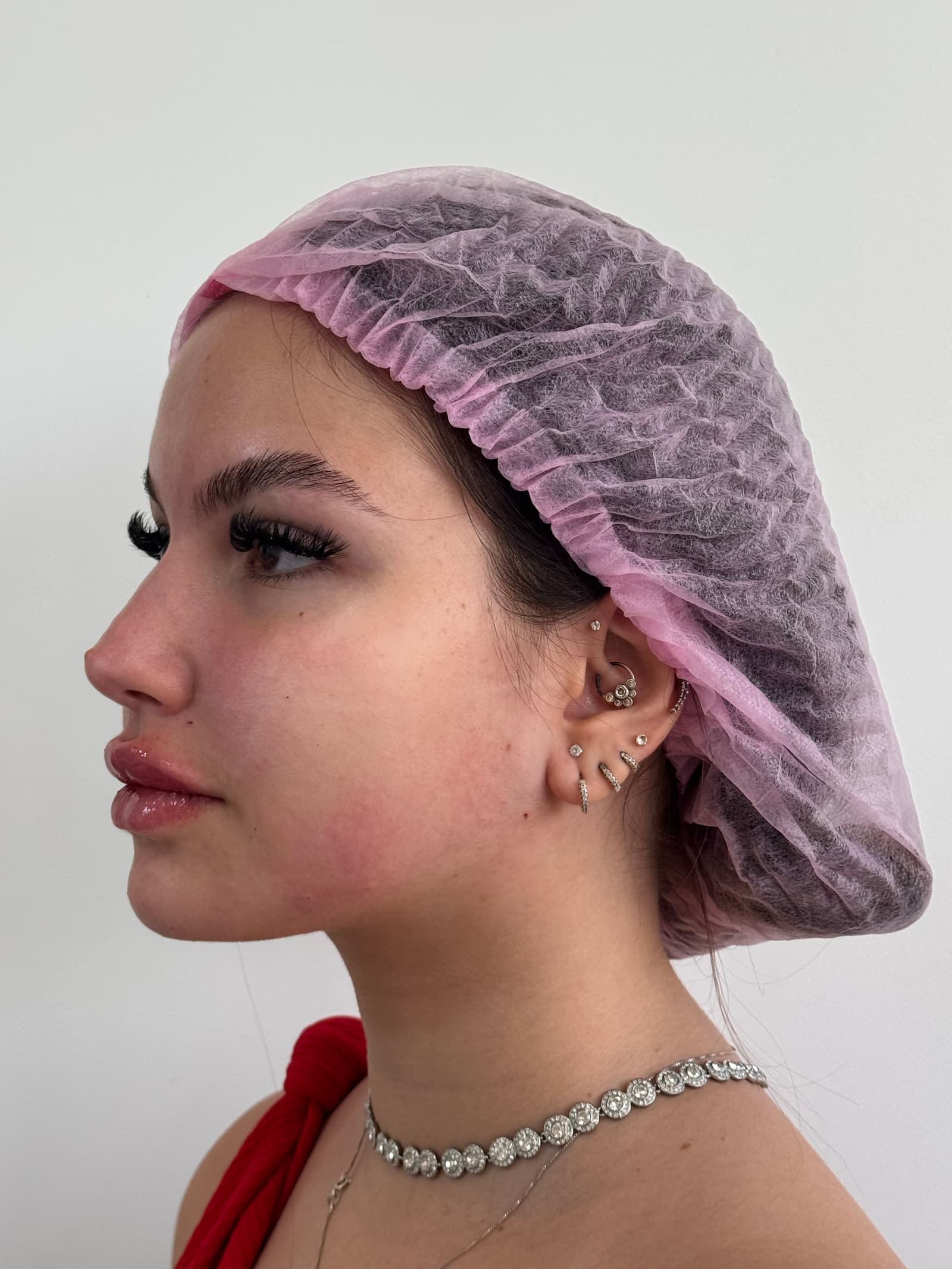 Harmonização facial em Belo Horizonte com resultado natural e sofisticado